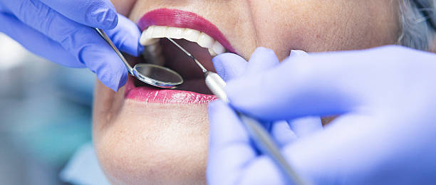 Best Emergency Denture Repair in Holly Lake Ranch, TX