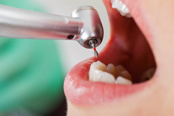 Best Urgent Dental Care for Toothaches in Holly Lake Ranch, TX
